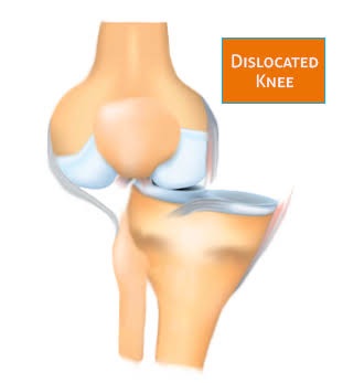 Long Beach and Bay St Louis